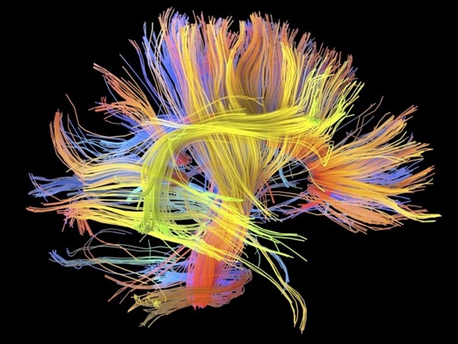 آیا میتوانیم دیاگرامی سیمی از مغز انسان بسازیم؟