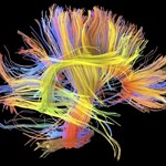 آیا میتوانیم دیاگرامی سیمی از مغز انسان بسازیم؟
