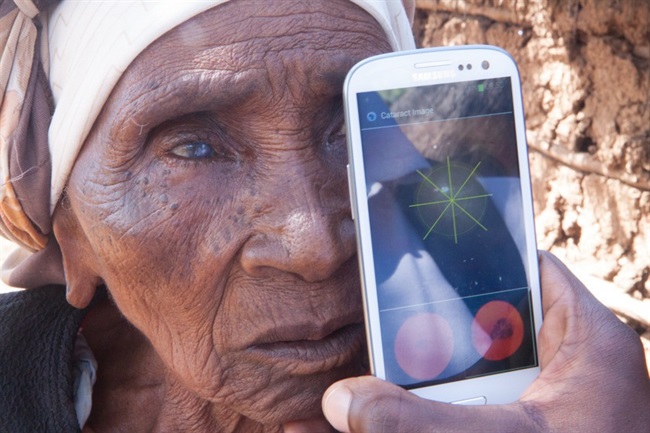 دوربینی برای تشخیص بیماری های چشمی برای مناطق در حال توسعه