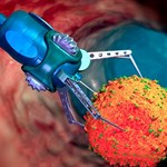 کمک نانوروبات ها به درمان سرطان