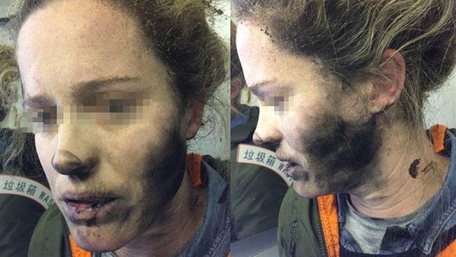 انفجار یک باتری دیگر در هواپیما، صورت یک خانم را دچار سوختگی کرد